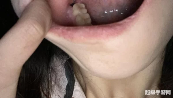 河南拔智齿